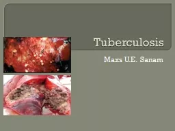 Tuberculosis Maxs U.E. Sanam