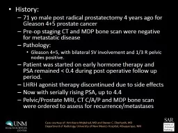 History:  71  yo  male post radical prostatectomy 4 years ago for Gleason 4+5 prostate