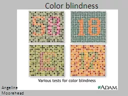 Angeline  M oorehead Color blindness