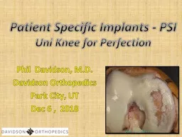 Patient Specific  Implants - PSI