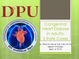Congenital Heart Disease in Adults: