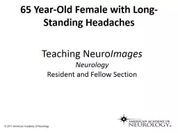 65 Year-Old Female with Long-Standing Headaches