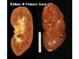 1 Kidney & Urinary tract