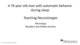 A 76 year old man with automatic behavior during sleep