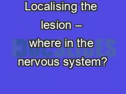 Localising the lesion – where in the nervous system?