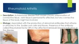 Rheumatoid Arthritis Description