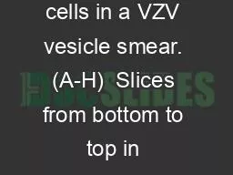 Fig. S1.  Z-stack of cells in a VZV vesicle smear. (A-H)  Slices from bottom to top in