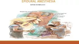 Epidural anesthesia