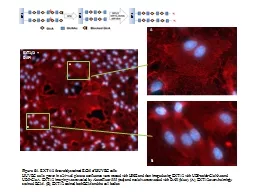 EXT1/2 + DAPI 20 µm A B