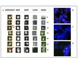 KER/DAPI   KER        DAPI       CD45      HER2