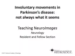 PPT-Involuntary movements in Parkinson’s disease: