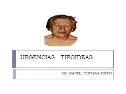 URGENCIAS   TIROIDEAS IM: DANIEL TINTAYA PINTO