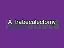 PPT-A trabeculectomy