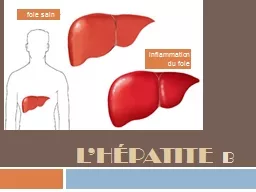 l’Hépatite   b inflammation du foie