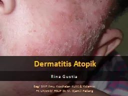 Dermatitis  Atopik Rina