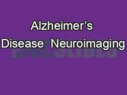 Alzheimer’s Disease  Neuroimaging