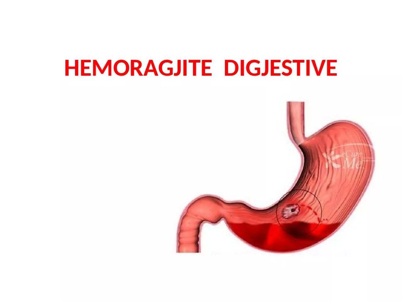 PPT-HEMORAGJITE DIGJESTIVE