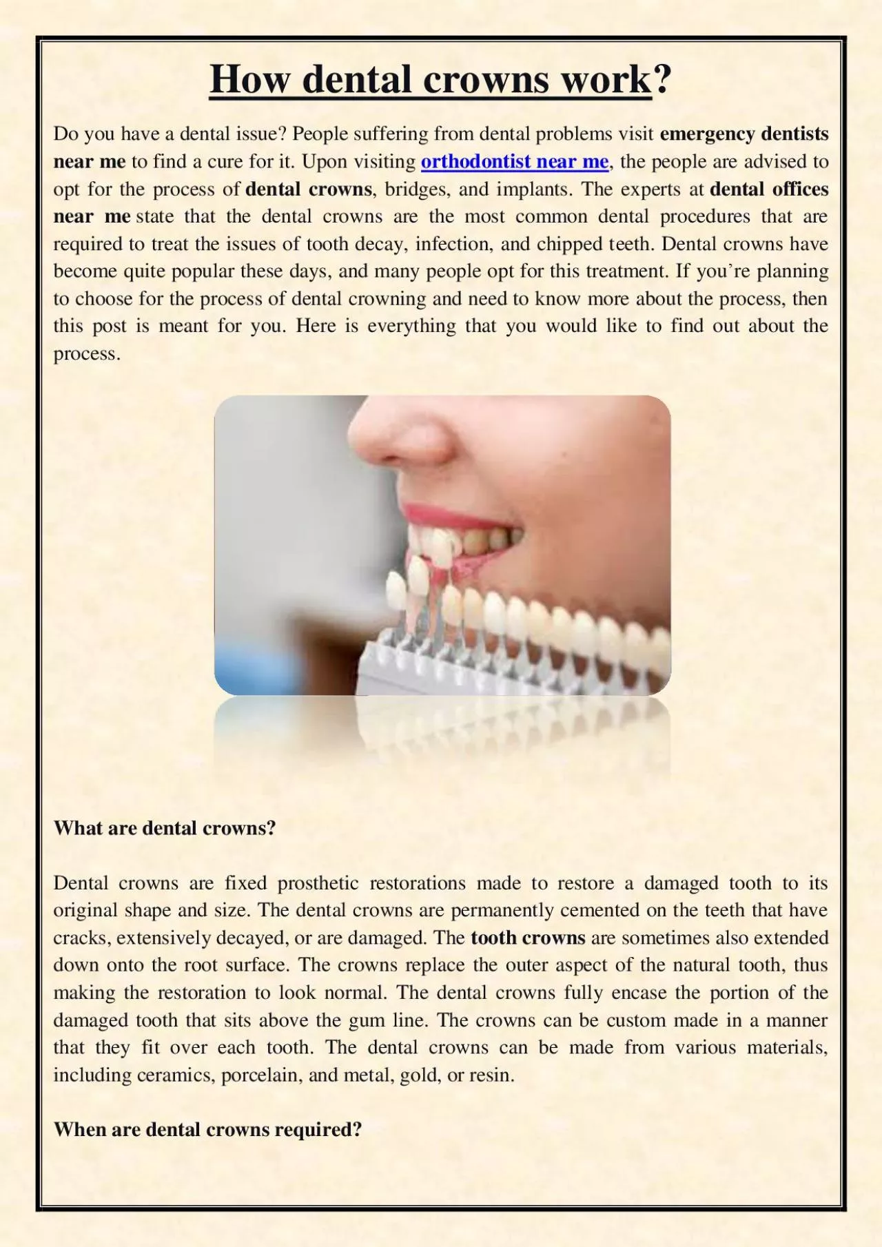 PDF-How dental crowns work?