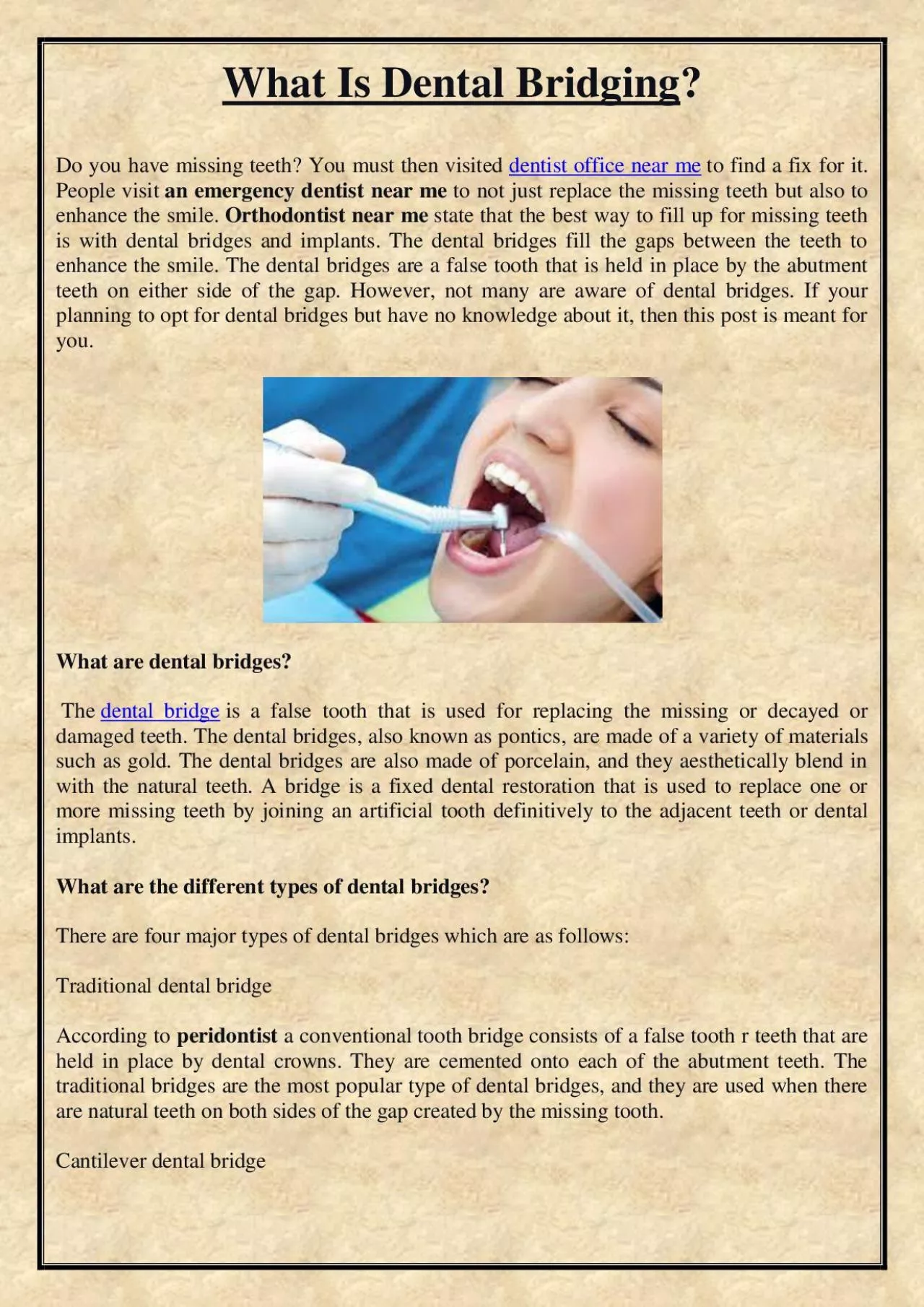 PDF-What Is Dental Bridging?