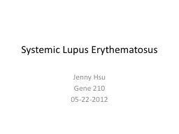 Systemic Lupus  Erythematosus