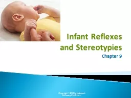 Infant Reflexes  and Stereotypies