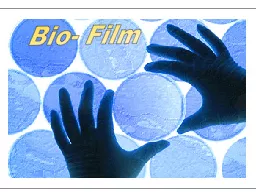 Bio- Film        A lot of stress is given today  towards infection control in Dental Practice.