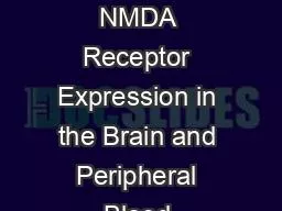 The Effects of Nicotine on NMDA Receptor Expression in the Brain and Peripheral Blood Lymphocytes o