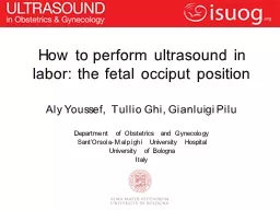 How to perform ultrasound in labor: the fetal occiput position