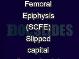 Slipped Capital Femoral Epiphysis (SCFE) Slipped capital femoral epiph