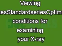 Viewing BoxesStandardseriesOptimum conditions for examining your X-ray