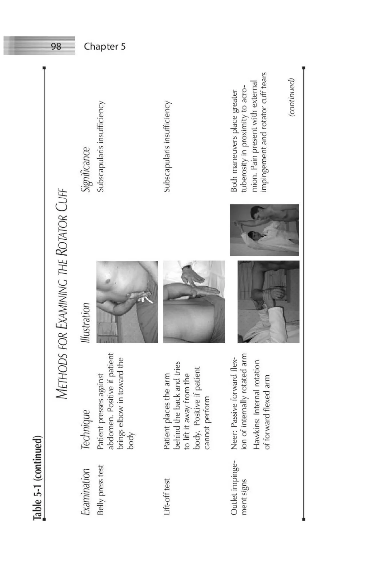 PDF-Subscapularis insufficiency