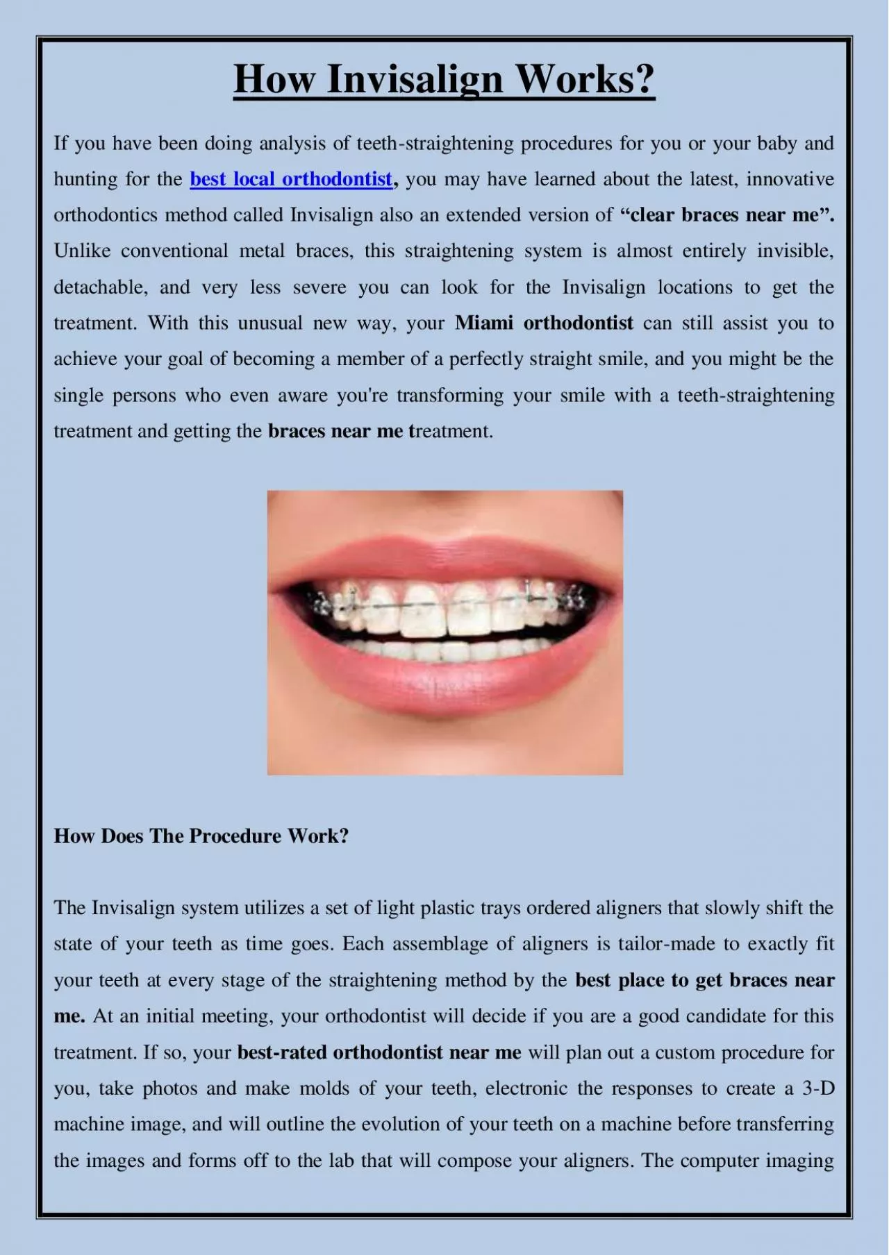 PDF-How Invisalign Works?