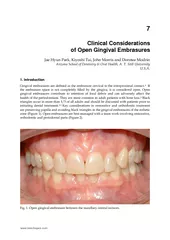 Clinical Considerations of Open Gingival Embrasures
