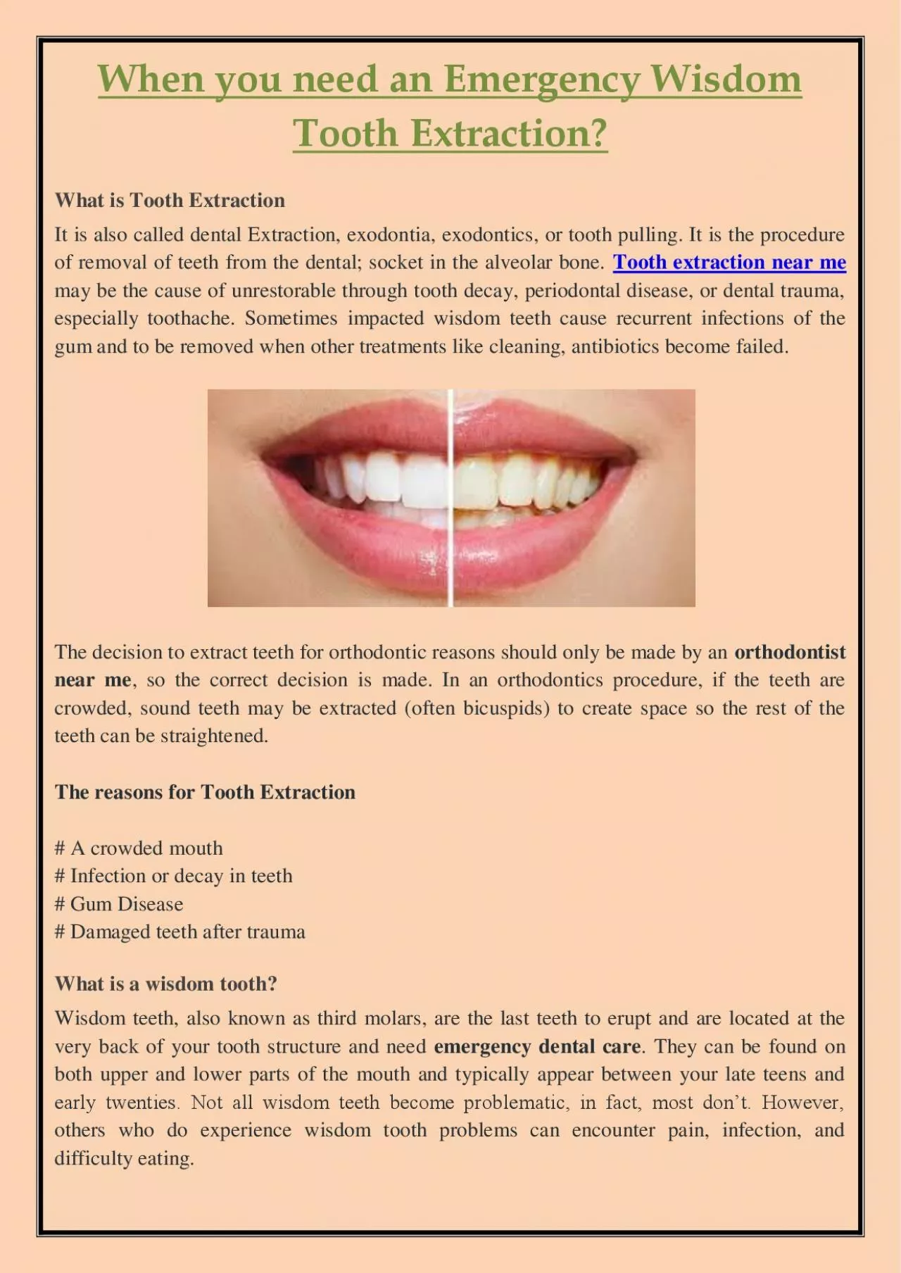 PDF-When you need an Emergency Wisdom Tooth Extraction?