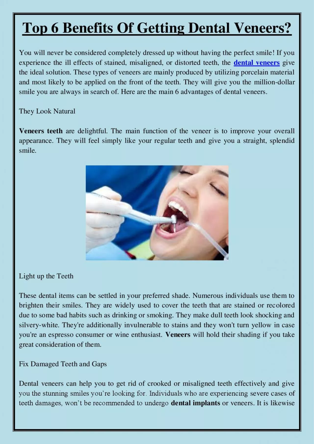 PDF-Top 6 Benefits Of Getting Dental Veneers?