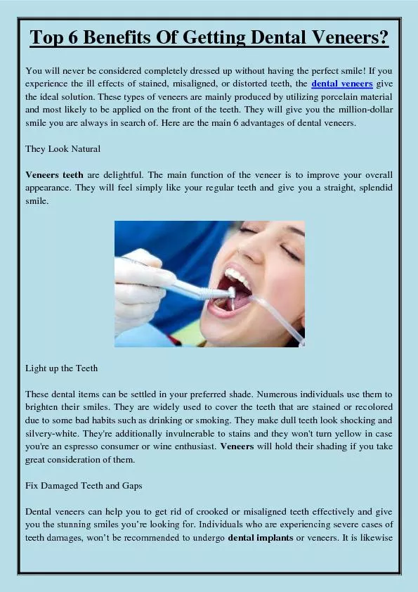 Top 6 Benefits Of Getting Dental Veneers?