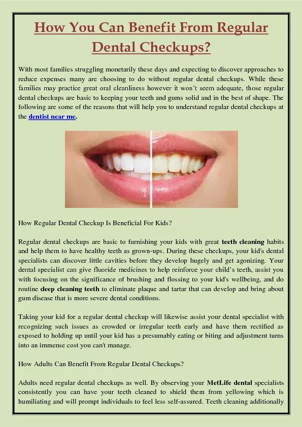 How You Can Benefit From Regular Dental Checkups?