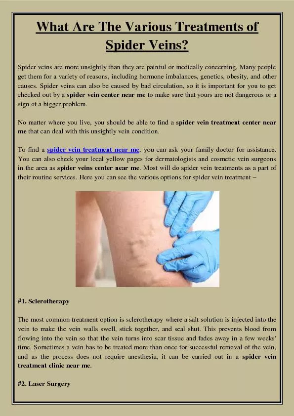 What Are The Various Treatments of Spider Veins?