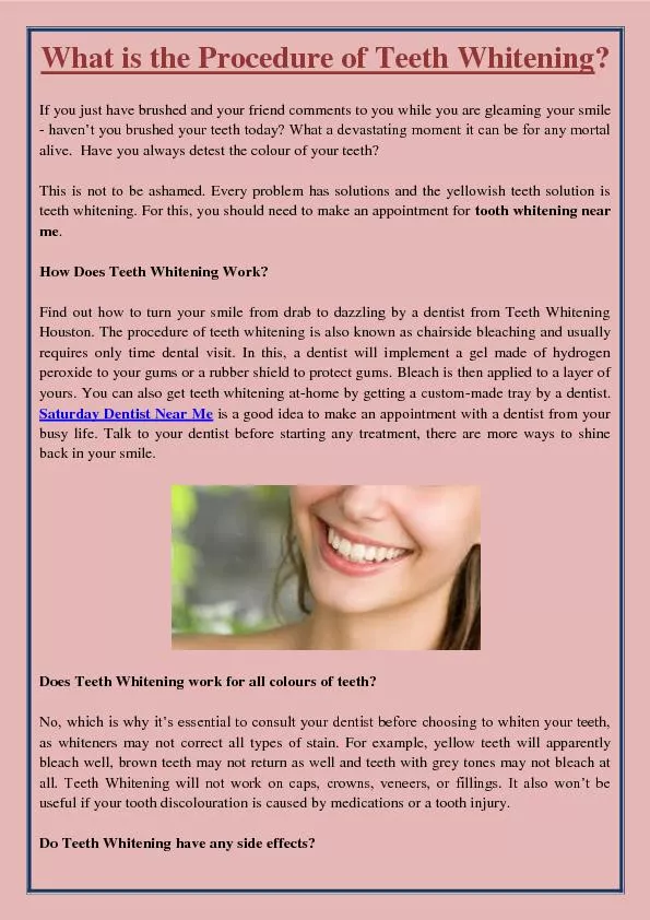 What is the Procedure of Teeth Whitening?