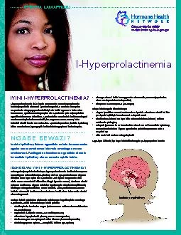 I-hyperprolactinemia yisifo lapho umuntu eba namazinga aphezulu kunoku