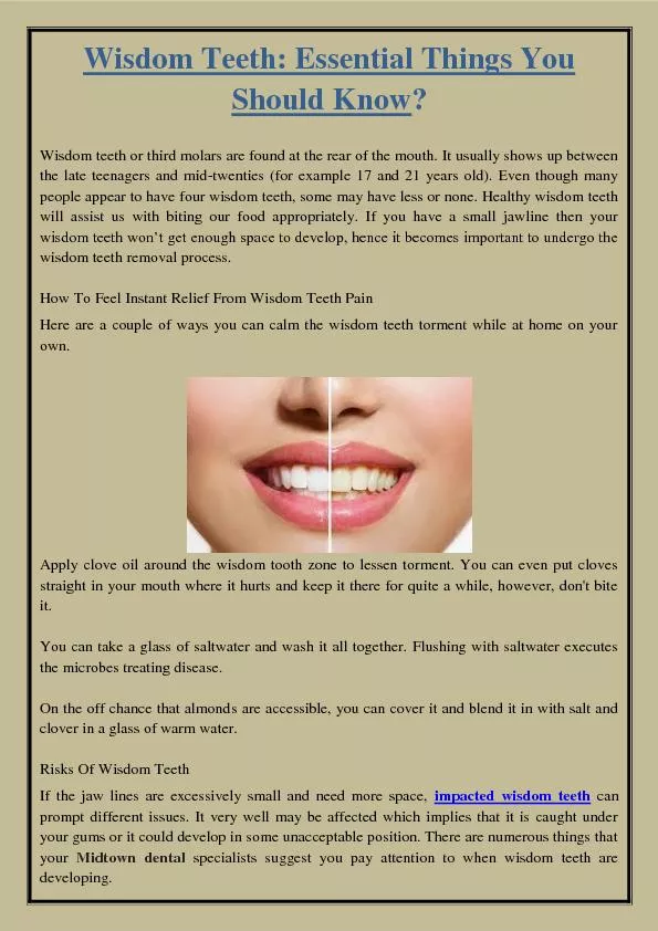 Wisdom Teeth: Essential Things You Should Know?