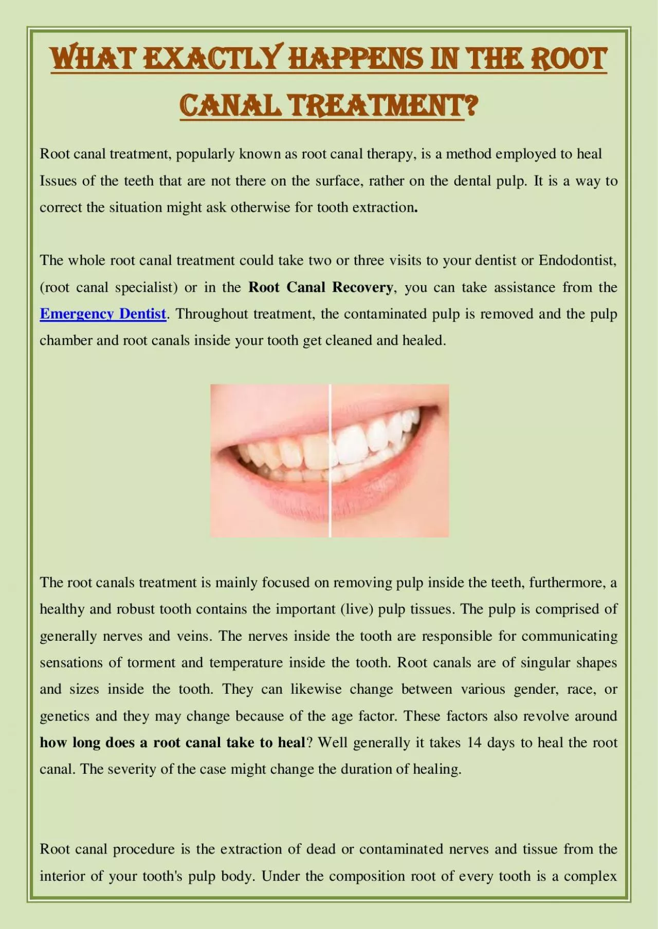 PDF-What Exactly Happens In The Root Canal Treatment?