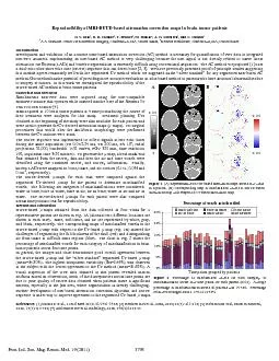 PDF-(slices at two different locations are