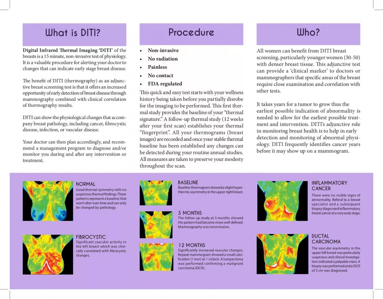 PDF-Digital Infrared ermal Imaging ‘DITI’