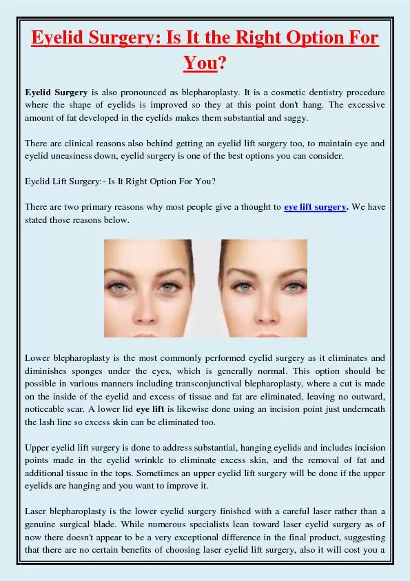 Eyelid Surgery: Is It the Right Option For You?