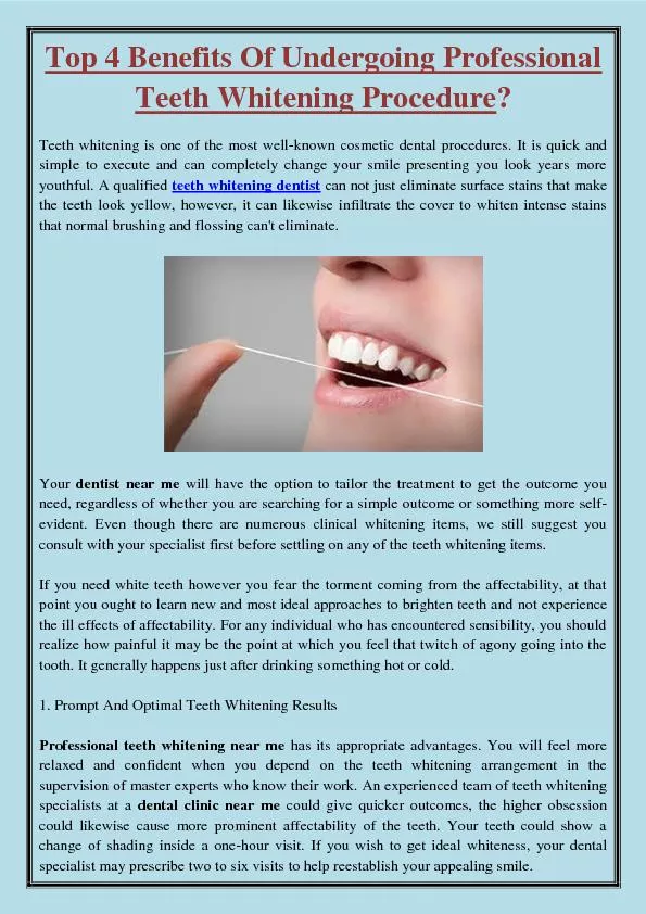 Top 4 Benefits Of Undergoing Professional Teeth Whitening Procedure?
