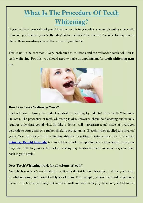 What Is The Procedure Of Teeth Whitening?