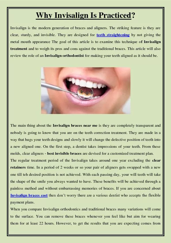 Why Invisalign Is Practiced?