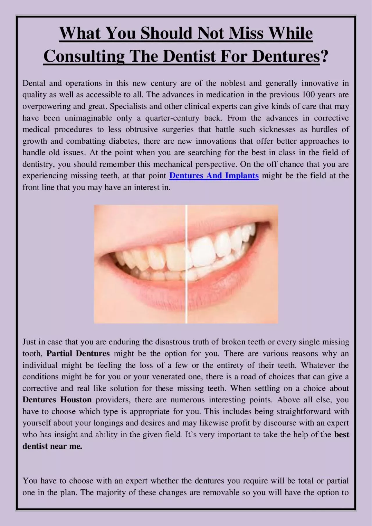 PDF-What You Should Not Miss While Consulting The Dentist For Dentures?