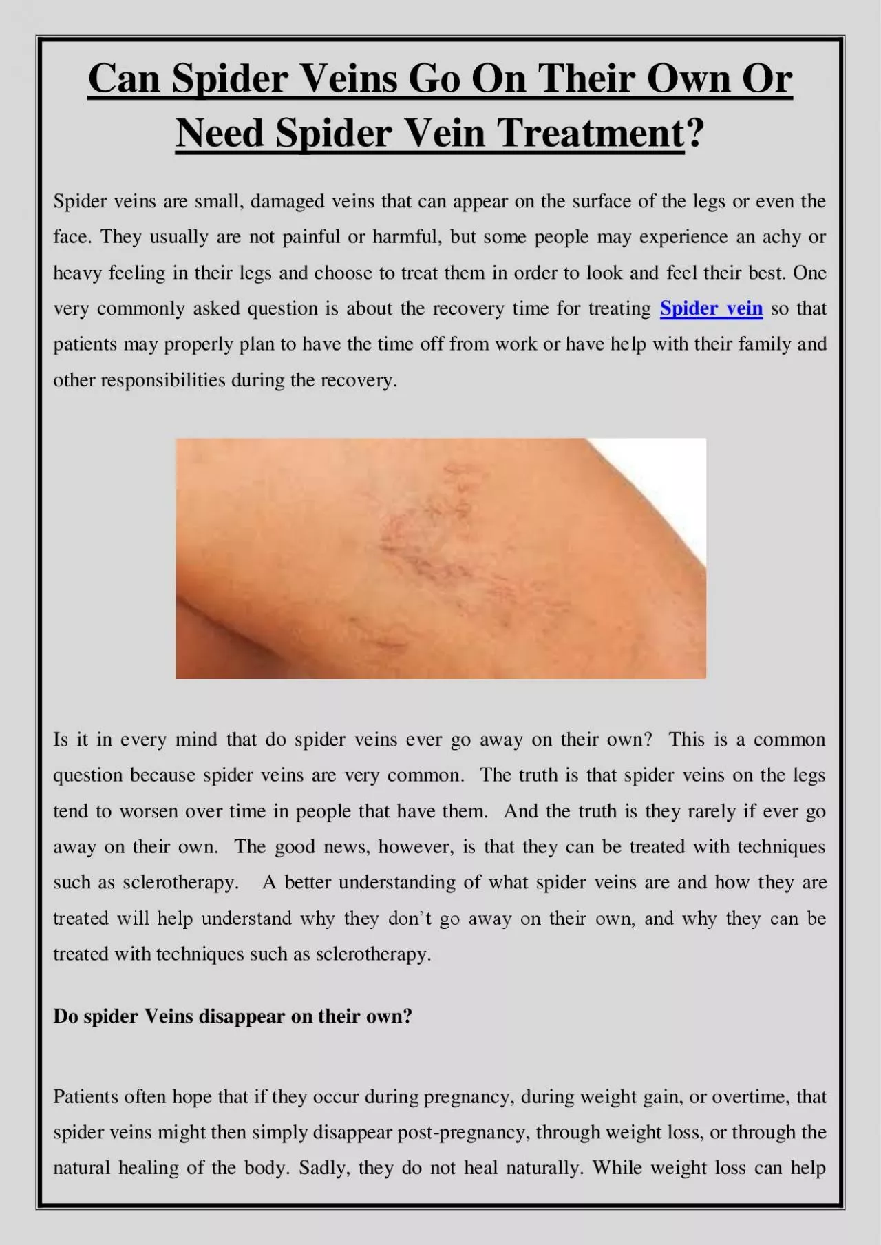 PDF-Can Spider Veins Go On Their Own Or Need Spider Vein Treatment?